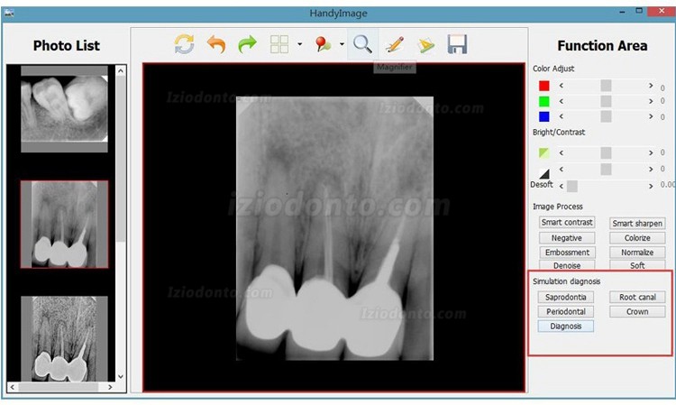 Alta resolução Tipo USB Digital Sensor Para Radiografia Odontológica Rvg HDR 500